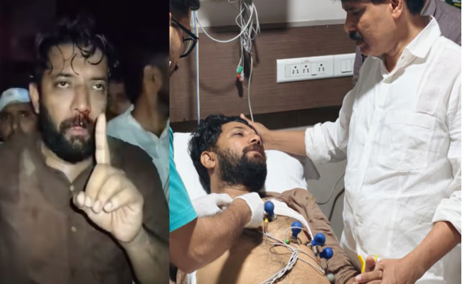 ഷാഫി പറമ്പിൽ എംപിയെ അടിയന്തിര ശാസ്ത്രക്രിയക്ക് വിധേയനാക്കി; മൂക്കിന് പൊട്ടൽ, ‘നരനായാട്ട് ഒരിക്കലും മറക്കില്ലെ’ന്ന് ടി സിദ്ദിഖ്