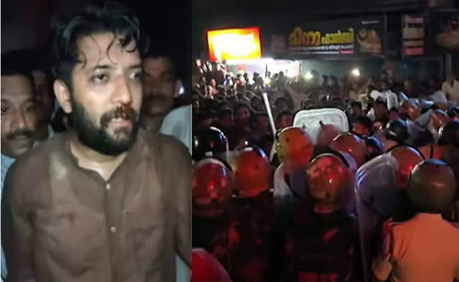 ഷാഫിയുടെ മൂക്കിന്‍റെ രണ്ട് അസ്ഥികളിൽ പൊട്ടൽ, ഇടത് അസ്ഥി സ്ഥാനം തെറ്റി; മെഡിക്കൽ ബുള്ളറ്റിൻ