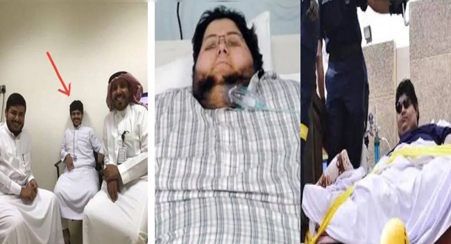 ‘ദി സ്മൈലിംഗ് മാന്‍’ ദുരവസ്ഥയില്‍ മനംനൊന്ത്; അബ്ദുള്ള രാജാവ് 33കാരന് സമ്മാനിച്ച പുതുജീവിതം,ഭൂമിയിലെ ഏറ്റവും ഭാരമേറിയ മനുഷ്യന് 542 കിലോ ഭാരം കുറഞ്ഞു