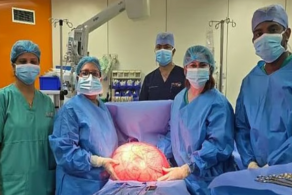 യുവതിയുടെ വയറ്റിൽ 14.5 കിലോ ഭാരമുള്ള മുഴ; ശസ്ത്രക്രിയയിലൂടെ പുറത്തെടുത്തു