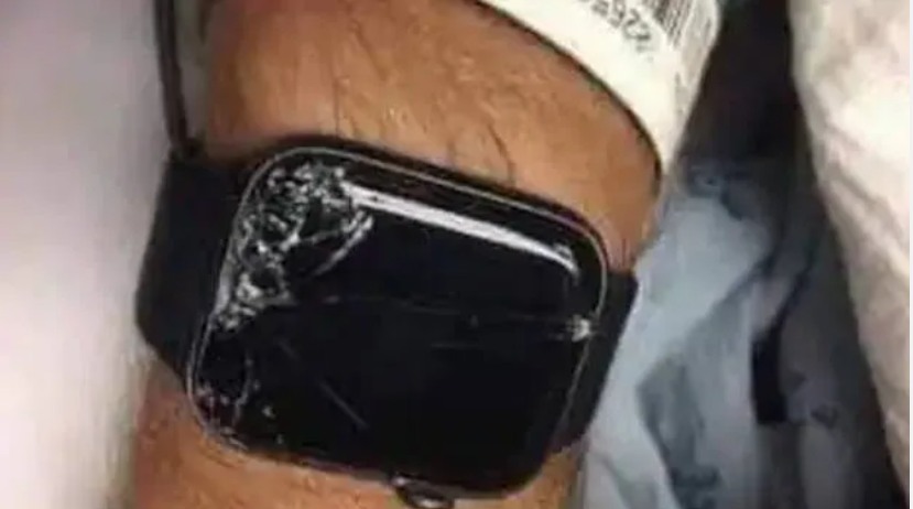 അപകടത്തിൽപ്പെട്ട് അബോധാവാസ്ഥവയിലായി; ജീവൻ രക്ഷിച്ചത് കൈയിൽ കെട്ടിയ സ്‌മാർട് വാച്ച്