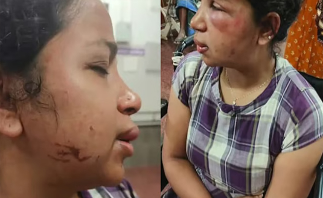 സ്‌നേഹം പ്രകടിപ്പിച്ച് വീട്ടില്‍ കൊണ്ടുപോയി, തല ഭിത്തിയില്‍ ഇടിച്ചു, മുഖം അടിച്ചുപൊട്ടിച്ചു’; കോട്ടയത്ത് യുവതിക്ക് ക്രൂരമര്‍ദ്ദനം, ഭര്‍ത്താവ് ഒളിവില്‍