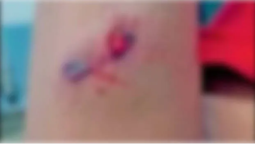 നോട്ട് എഴുതി തീർന്നില്ല, കുട്ടിയെ ക്രൂരമായി മർദിച്ച് ട്യൂഷൻ സെന്റർ ഉടമ